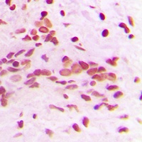 PCNA Rabbit Polyclonal Antibody