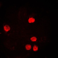 PCNA Rabbit Polyclonal Antibody