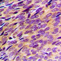 PDE4B/C/D Rabbit Polyclonal Antibody
