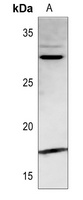 PDGFA Rabbit Polyclonal Antibody