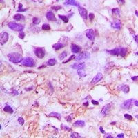PDGFA Rabbit Polyclonal Antibody