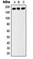 PDGFR beta Rabbit Polyclonal Antibody
