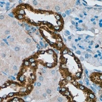 PDGFR beta Rabbit Polyclonal Antibody