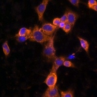 PDGFR beta Rabbit Polyclonal Antibody