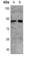 PFKP Rabbit Polyclonal Antibody