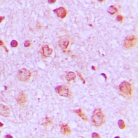 PFKP Rabbit Polyclonal Antibody