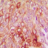 Serpin B5 Rabbit Polyclonal Antibody