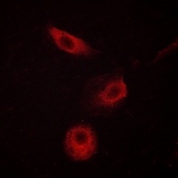 PLC gamma 2 (Phospho-Y1217) Rabbit Polyclonal Antibody