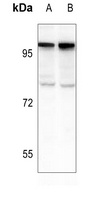 PML Rabbit Polyclonal Antibody