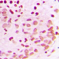 PML Rabbit Polyclonal Antibody