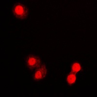 PML Rabbit Polyclonal Antibody