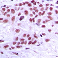 TRAP220 Rabbit Polyclonal Antibody