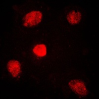 TRAP220 Rabbit Polyclonal Antibody