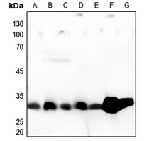 Cathepsin A 32k Rabbit Polyclonal Antibody