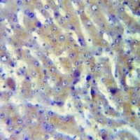 Cathepsin A 32k Rabbit Polyclonal Antibody
