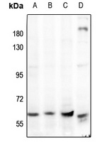 AMPK alpha 1/2 Rabbit Polyclonal Antibody