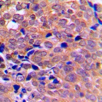 AMPK alpha 1/2 Rabbit Polyclonal Antibody