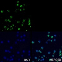 AMPK alpha 1/2 Rabbit Polyclonal Antibody