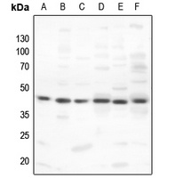 PKA C alpha/beta Rabbit Polyclonal Antibody