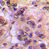 PKA C alpha/beta Rabbit Polyclonal Antibody