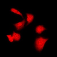 PKA C alpha/beta Rabbit Polyclonal Antibody