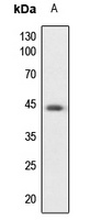 PKA C alpha/beta/gamma Rabbit Polyclonal Antibody