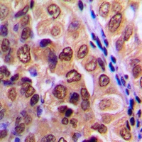 PKA C alpha/beta/gamma Rabbit Polyclonal Antibody
