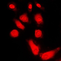 PKA C alpha/beta/gamma Rabbit Polyclonal Antibody