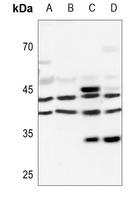 PRKAR1A Rabbit Polyclonal Antibody