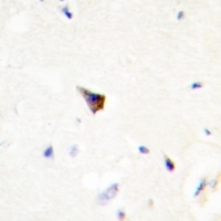 PRKAR1A Rabbit Polyclonal Antibody