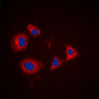 PRKAR1A Rabbit Polyclonal Antibody
