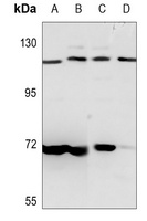 PKN1 Rabbit Polyclonal Antibody