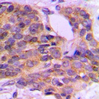 PKC theta (Phospho-S676) Rabbit Polyclonal Antibody