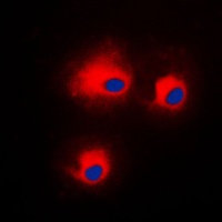 PKC theta (Phospho-S676) Rabbit Polyclonal Antibody