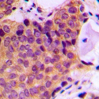 JNK1/2/3 (Phospho-T183) Rabbit Polyclonal Antibody