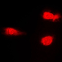 JNK1/2/3 (Phospho-T183) Rabbit Polyclonal Antibody