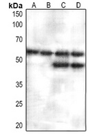 JNK1/2/3 Rabbit Polyclonal Antibody