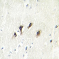 JNK1/2/3 Rabbit Polyclonal Antibody