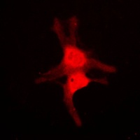 JNK1/2/3 Rabbit Polyclonal Antibody