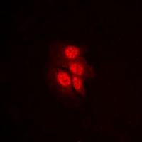 MKK1 (Phospho-T292) Rabbit Polyclonal Antibody