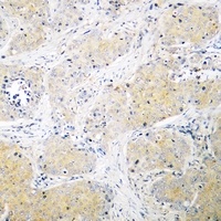 PSMD3 Rabbit Polyclonal Antibody
