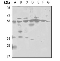 PSMD12 Rabbit Polyclonal Antibody