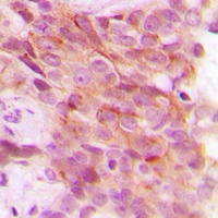 PSMD12 Rabbit Polyclonal Antibody
