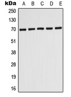 ABCD3 Rabbit Polyclonal Antibody