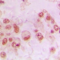 RAD23B Rabbit Polyclonal Antibody