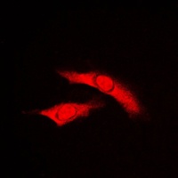 RAD23B Rabbit Polyclonal Antibody