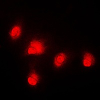 c-RAF Rabbit Polyclonal Antibody