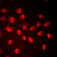 RB1 (Phospho-S780) Rabbit Polyclonal Antibody