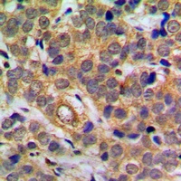 NF-kappaB p65 (Phospho-S311) Rabbit Polyclonal Antibody
