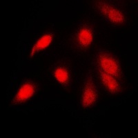 NF-kappaB p65 (Phospho-S311) Rabbit Polyclonal Antibody